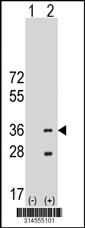 Western blot analysis of his-tag MCART1 (arrow) using his tag antibody. 293 cell lysates (2 ug/lane) either nontransfected (Lane 60) or transiently transfected with theMCART1 gene.