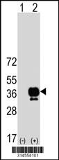 Western blot analysis of his-tag PLSCR3 (arrow) using his tag antibody. 293 cell lysates (2 ug/lane) either nontransfected (Lane 87) or transiently transfected with thePLSCR3 gene.
