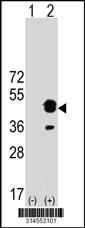 Western blot analysis of his-tag C21orf91 (arrow) using his tag antibody. 293 cell lysates (2 ug/lane) either nontransfected (Lane 120) or transiently transfected with theC21orf91 gene.