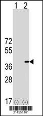 Western blot analysis of his-tag OTUD6B (arrow) using his tag antibody. 293 cell lysates (2 ug/lane) either nontransfected (Lane 168) or transiently transfected with theOTUD6B gene.
