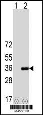 Western blot analysis of his-tag LIX1 (arrow) using his tag antibody. 293 cell lysates (2 ug/lane) either nontransfected (Lane 197) or transiently transfected with theLIX1 gene.