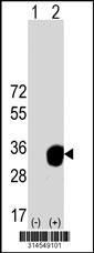 Western blot analysis of his-tag SIX1 (arrow) using his tag antibody. 293 cell lysates (2 ug/lane) either nontransfected (Lane 66) or transiently transfected with theSIX1 gene.
