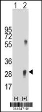 Western blot analysis of his-tag TSPAN18 (arrow) using his tag antibody. 293 cell lysates (2 ug/lane) either nontransfected (Lane 140) or transiently transfected with theTSPAN18 gene.
