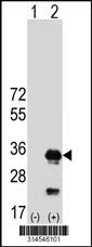 Western blot analysis of his-tag STX6 (arrow) using his tag antibody. 293 cell lysates (2 ug/lane) either nontransfected (Lane 73) or transiently transfected with theSTX6 gene.
