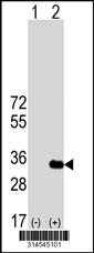 Western blot analysis of his-tag C18orf24 (arrow) using his tag antibody. 293 cell lysates (2 ug/lane) either nontransfected (Lane 122) or transiently transfected with theC18orf24 gene.