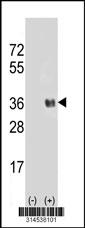 Western blot analysis of his-tag SC4MOL (arrow) using his tag antibody. 293 cell lysates (2 ug/lane) either nontransfected (Lane 78) or transiently transfected with theSC4MOL gene.