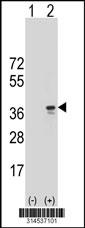 Western blot analysis of his-tag RWDD2A (arrow) using his tag antibody. 293 cell lysates (2 ug/lane) either nontransfected (Lane 82) or transiently transfected with theRWDD2A gene.