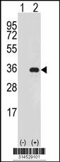 Western blot analysis of his-tag TSNAX (arrow) using his tag antibody. 293 cell lysates (2 ug/lane) either nontransfected (Lane 75) or transiently transfected with theTSNAX gene.