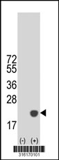 Western blot analysis of his-tag BTG2 (arrow) using his tag antibody. 293T cell lysates (2 ug/lane) either nontransfected (Lane 1) or transiently transfected with the BTG2 gene‘