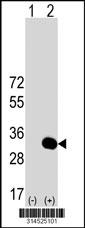 Western blot analysis of his-tag WDR25 (arrow) using his tag antibody. 293 cell lysates (2 ug/lane) either nontransfected (Lane 28) or transiently transfected with theWDR25 gene.