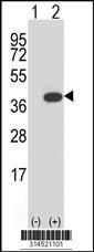 Western blot analysis of his-tag HYLS1 (arrow) using his tag antibody. 293 cell lysates (2 ug/lane) either nontransfected (Lane 115) or transiently transfected with theHYLS1 gene.