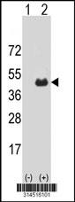 Western blot analysis of his-tag FHL5 (arrow) using his tag antibody. 293 cell lysates (2 ug/lane) either nontransfected (Lane 142) or transiently transfected with theFHL5 gene.