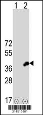 Western blot analysis of his-tag ERMN (arrow) using his tag antibody. 293 cell lysates (2 ug/lane) either nontransfected (Lane 159) or transiently transfected with theERMN gene.