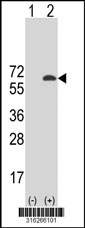 Western blot analysis of his-tag EHD2 (arrow) using his tag antibody. 293T cell lysates (2 ug/lane) either nontransfected (Lane 1) or transiently transfected with the EHD2 gene‘