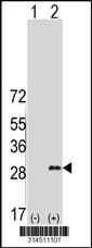 Western blot analysis of his-tag RASD1 (arrow) using his tag antibody. 293 cell lysates (2 ug/lane) either nontransfected (Lane 136) or transiently transfected with theRASD1 gene.