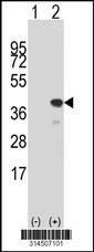 Western blot analysis of his-tag CENPK (arrow) using his tag antibody. 293 cell lysates (2 ug/lane) either nontransfected (Lane 1) or transiently transfected with the CENPK gene.