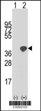 Western blot analysis of his-tag RPS3A (arrow) using his tag antibody. 293 cell lysates (2 ug/lane) either nontransfected (Lane 1) or transiently transfected with the RPS3A gene.