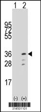 Western blot analysis of his-tag RPS4Y1 (arrow) using his tag antibody. 293 cell lysates (2 ug/lane) either nontransfected (Lane 1) or transiently transfected with the RPS4Y1 gene.