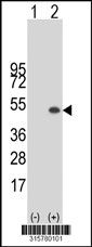 Western blot analysis of his-tag SLC35B2 (arrow) using his tag antibody. 293T cell lysates (2 ug/lane) either nontransfected (Lane 1) or transiently transfected with the SLC35B2 gene‘