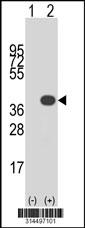 Western blot analysis of his-tag SRrp35 (arrow) using his tag antibody. 293 cell lysates (2 ug/lane) either nontransfected (Lane 1) or transiently transfected with the SRrp35 gene.