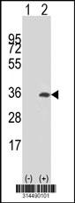 Western blot analysis of his-tag KRCC1 (arrow) using his tag antibody. 293 cell lysates (2 ug/lane) either nontransfected (Lane 1) or transiently transfected with the KRCC1 gene.