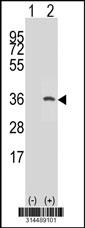 Western blot analysis of his-tag CCDC127 (arrow) using his tag antibody. 293 cell lysates (2 ug/lane) either nontransfected (Lane 1) or transiently transfected with the CCDC127 gene.