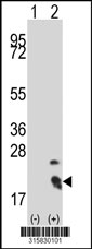 Western blot analysis of his-tag MRFAP1 (arrow) using his tag antibody. 293T cell lysates (2 ug/lane) either nontransfected (Lane 1) or transiently transfected with the MRFAP1 gene‘