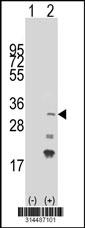 Western blot analysis of his-tag C1orf89 (arrow) using his tag antibody. 293 cell lysates (2 ug/lane) either nontransfected (Lane 1) or transiently transfected with the C1orf89 gene.
