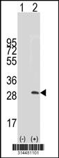 Western blot analysis of his-tag HHIPL2 (arrow) using his tag antibody. 293 cell lysates (2 ug/lane) either nontransfected (Lane 1) or transiently transfected with the HHIPL2 gene.