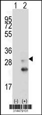 Western blot analysis of his-tag SUSD3 (arrow) using his tag antibody. 293 cell lysates (2 ug/lane) either nontransfected (Lane 1) or transiently transfected with the SUSD3 gene.