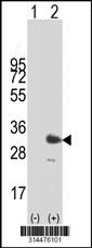 Western blot analysis of his-tag PCGF1 (arrow) using his tag antibody. 293 cell lysates (2 ug/lane) either nontransfected (Lane 1) or transiently transfected with the PCGF1 gene.