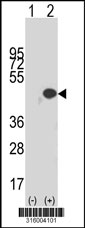 Western blot analysis of his-tag PABPC5 (arrow) using his tag antibody. 293T cell lysates (2 ug/lane) either nontransfected (Lane 1) or transiently transfected with the PABPC5 gene‘