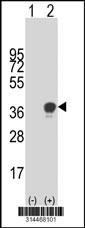 Western blot analysis of his-tag C9orf30 (arrow) using his tag antibody. 293 cell lysates (2 ug/lane) either nontransfected (Lane 1) or transiently transfected with the C9orf30 gene.