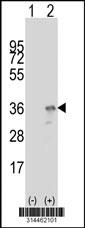 Western blot analysis of his-tag OTUB1 (arrow) using his tag antibody. 293 cell lysates (2 ug/lane) either nontransfected (Lane 1) or transiently transfected with the OTUB1 gene.