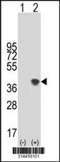 Western blot analysis of his-tag NIP30 (arrow) using his tag antibody. 293 cell lysates (2 ug/lane) either nontransfected (Lane 1) or transiently transfected with the NIP30 gene.