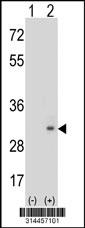 Western blot analysis of his-tag GLIPR1L2 (arrow) using his tag antibody. 293 cell lysates (2 ug/lane) either nontransfected (Lane 167) or transiently transfected with theGLIPR1L2 gene.