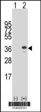 Western blot analysis of his-tag CDCA5 (arrow) using his tag antibody. 293 cell lysates (2 ug/lane) either nontransfected (Lane 1) or transiently transfected with the CDCA5 gene.