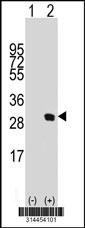 Western blot analysis of his-tag SLC25A41 (arrow) using his tag antibody. 293 cell lysates (2 ug/lane) either nontransfected (Lane 1) or transiently transfected with the SLC25A41 gene.