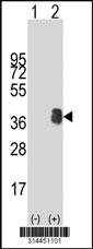 Western blot analysis of his-tag TXNDC1 (arrow) using his tag antibody. 293 cell lysates (2 ug/lane) either nontransfected (Lane 1) or transiently transfected with the TXNDC1 gene.