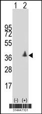 Western blot analysis of his-tag C3orf26 (arrow) using his tag antibody. 293 cell lysates (2 ug/lane) either nontransfected (Lane 1) or transiently transfected with the C3orf26 gene.