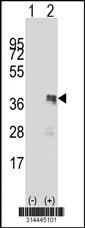 Western blot analysis of his-tag PLEKHF1 (arrow) using his tag antibody. 293 cell lysates (2 ug/lane) either nontransfected (Lane 1) or transiently transfected with the PLEKHF1 gene.