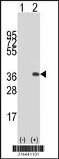 Western blot analysis of his-tag UTP11L (arrow) using his tag antibody. 293 cell lysates (2 ug/lane) either nontransfected (Lane 1) or transiently transfected with the UTP11L gene.