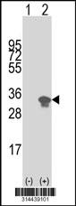 Western blot analysis of his-tag UTP23 (arrow) using his tag antibody. 293 cell lysates (2 ug/lane) either nontransfected (Lane 1) or transiently transfected with the UTP23 gene.