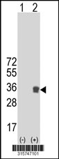 Western blot analysis of his-tag OSMR (arrow) using his tag antibody. 293T cell lysates (2 ug/lane) either nontransfected (Lane 1) or transiently transfected with the OSMR gene‘