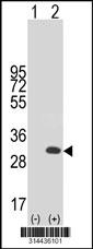 Western blot analysis of his-tag MITD1 (arrow) using his tag antibody. 293 cell lysates (2 ug/lane) either nontransfected (Lane 1) or transiently transfected with the MITD1 gene.