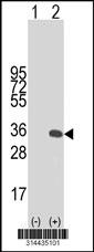 Western blot analysis of his-tag PLEKHF2 (arrow) using his tag antibody. 293 cell lysates (2 ug/lane) either nontransfected (Lane 1) or transiently transfected with the PLEKHF2 gene.