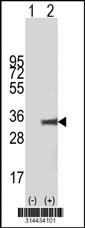 Western blot analysis of his-tag NIPSNAP3B (arrow) using his tag antibody. 293 cell lysates (2 ug/lane) either nontransfected (Lane 1) or transiently transfected with the NIPSNAP3B gene.