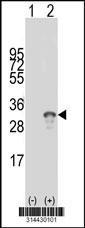 Western blot analysis of his-tag EXOSC4 (arrow) using his tag antibody. 293 cell lysates (2 ug/lane) either nontransfected (Lane 1) or transiently transfected with the EXOSC4 gene.