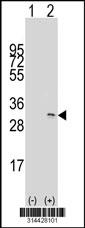 Western blot analysis of his-tag CNOT7 (arrow) using his tag antibody. 293 cell lysates (2 ug/lane) either nontransfected (Lane 1) or transiently transfected with the CNOT7 gene.
