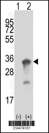 Western blot analysis of his-tag VAPB (arrow) using his tag antibody. 293 cell lysates (2 ug/lane) either nontransfected (Lane 1) or transiently transfected with the VAPB gene.